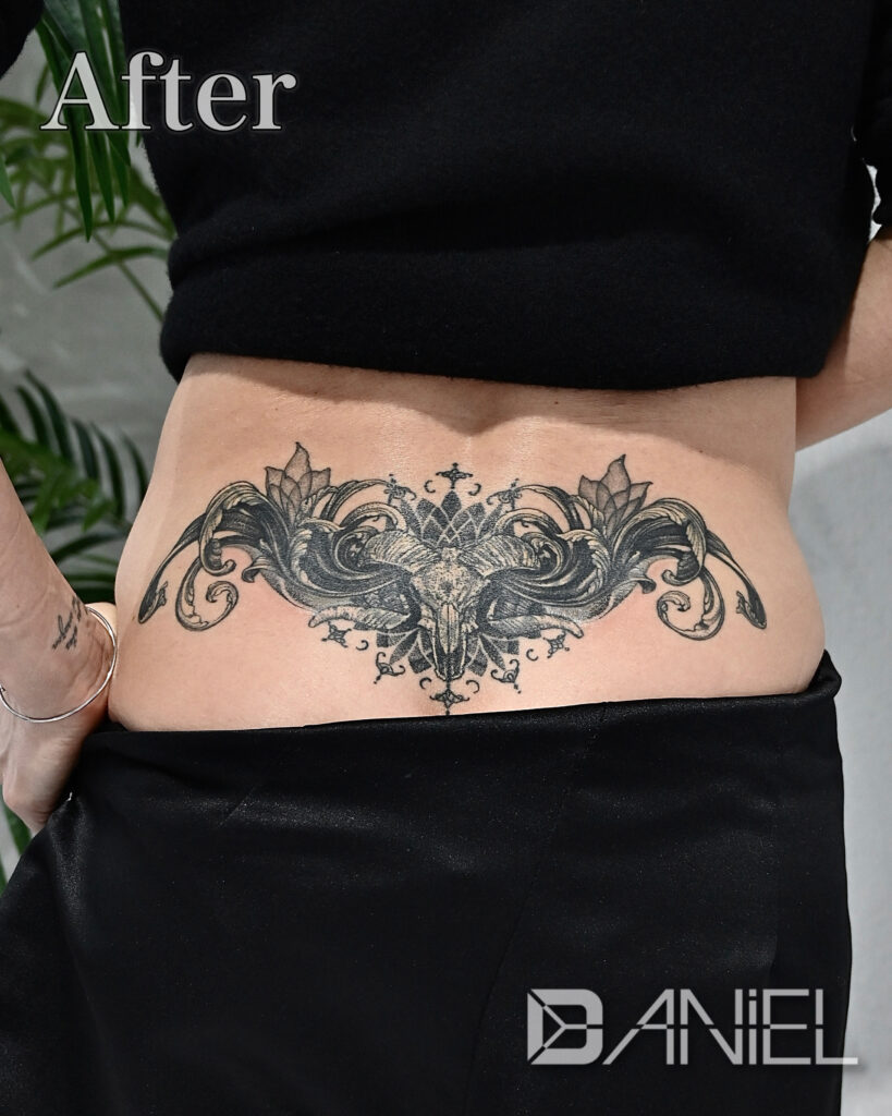 cover up skull & acanthus tattoo daniel after