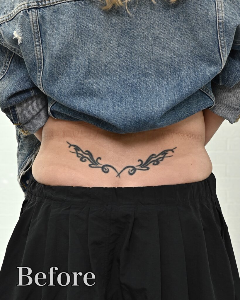 cover up skull & acanthus tattoo daniel before