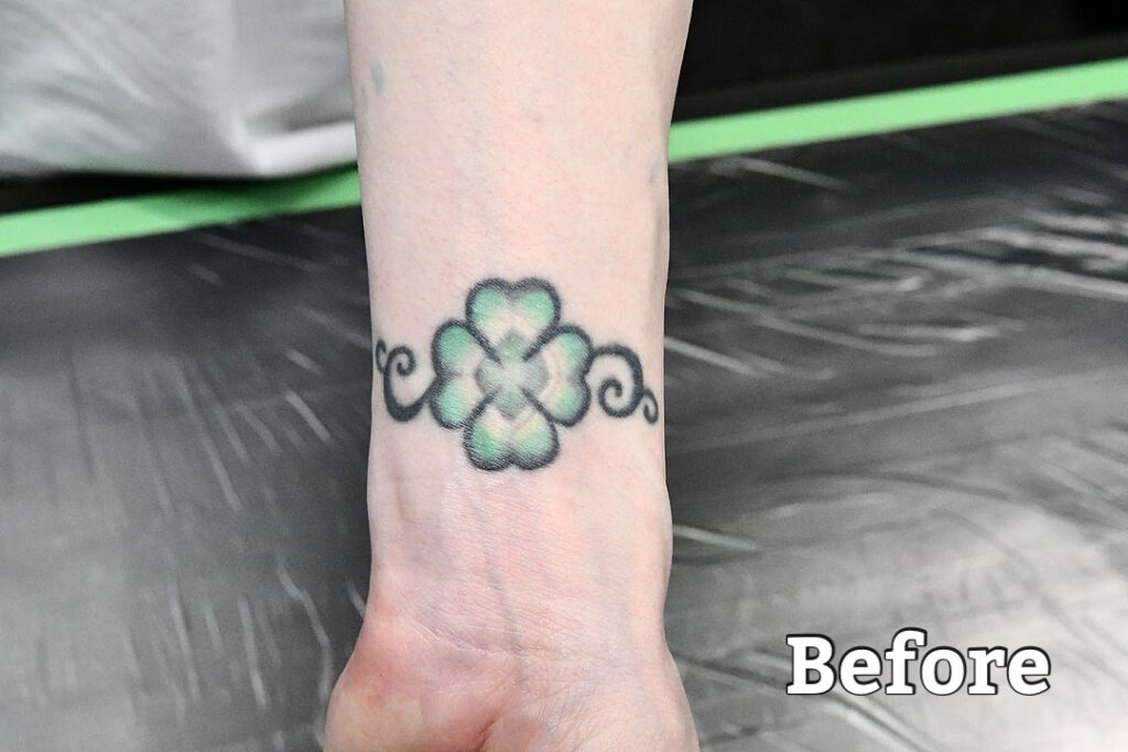 cover up tattoo clover peony Daniel before