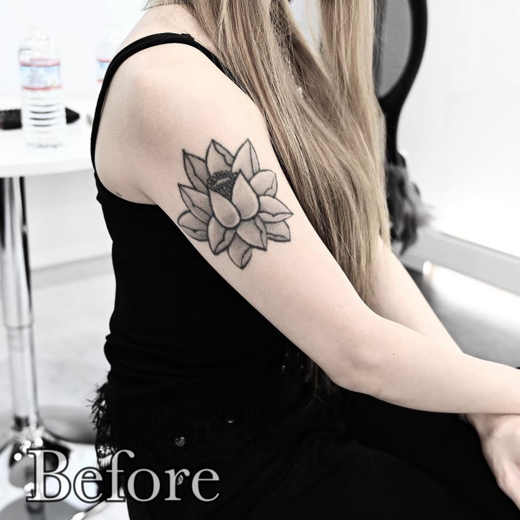 peony&mandala cover up tattoo daniel before